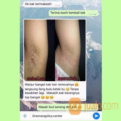 Obat Herbal Perontok Bulu Paket Maksimal