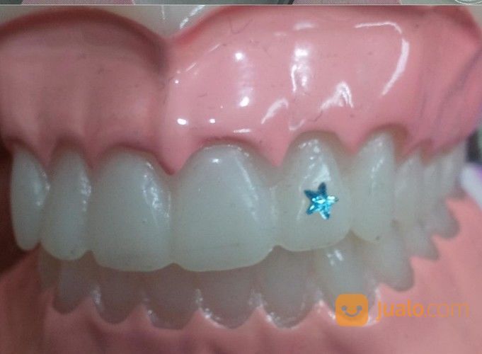 Diamond Gigi Crytal Gigi Berlian Gigi Permata Gigi Dental Gems Isi 5