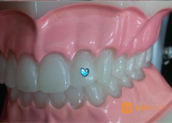 Diamond Gigi Crytal Gigi Berlian Gigi Permata Gigi Dental Gems Isi 5