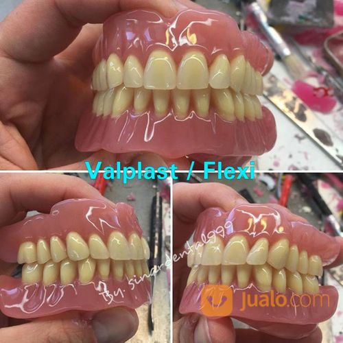 Pasang Gigi Tiruan / Dentur