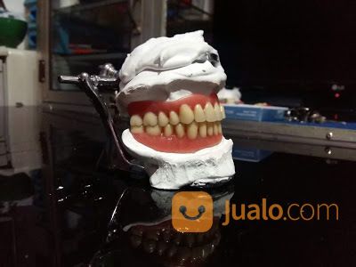 Pasang Gigi Tiruan / Dentur