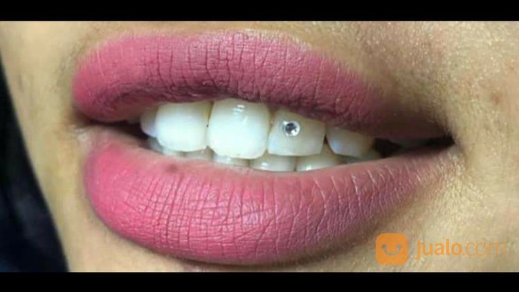 Pasang Diamond Gigi