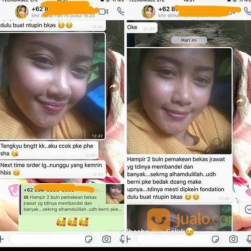 Phe Sha Beauty Cream Perawatan Penghilang Jerawat Alami 100% Original