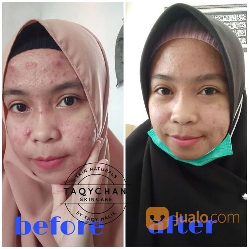 Taqychan Skincare Paket Lengkap With Saffron Extract