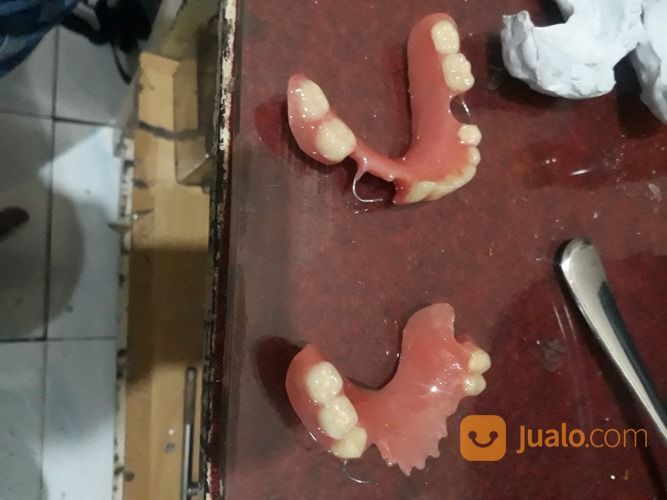 MELAYANI PEMASANGAN GIGI PALSU