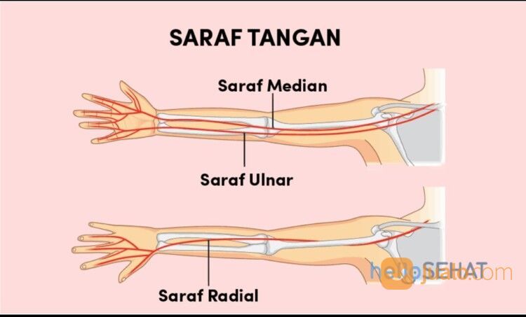 SARAF KEJEPIT / SAKIT PINGGANG (HNP)