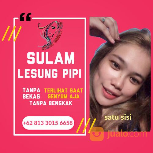 Sulam Lesung Pipi Termurah Bisa Dipanggil Kerumah Area Surabaya Malang Yogyakarta