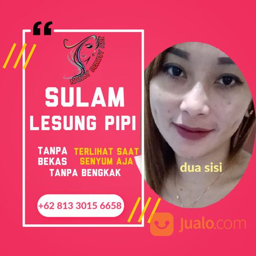 Sulam Lesung Pipi Termurah Bisa Dipanggil Kerumah Area Surabaya Malang Yogyakarta
