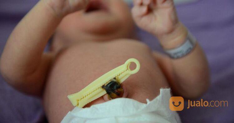 Jasa Perawatan Tali Pusar Bayi Di Tangerang Terbaik