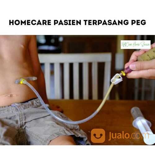 Tersedia perawat Home Care Untuk Pasien PEG