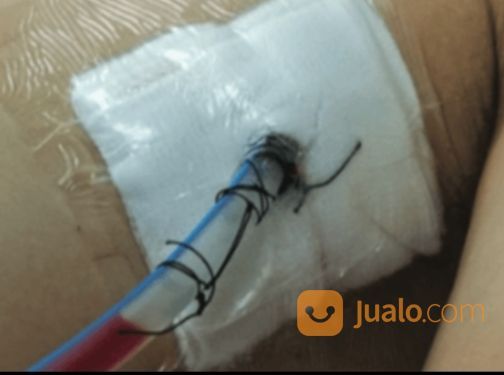 Perawatan Home Care Pasien Dengan Alat WSD/Pnuemothorax