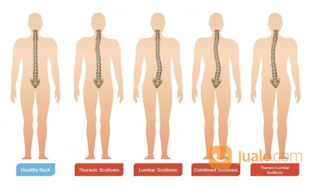 Chiropractic / Kretek - Kretek Atasi Masalah Tulang Belakang