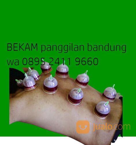 Bekam Panggilan Bandung Ke Rumah Baleendah Buah Batu Bojong Soang