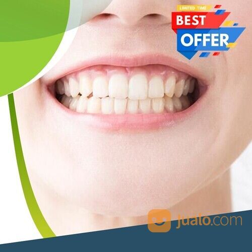 WA 082I-IS3O-82SO Klinik Gigi Ciwidey Global Estetik Festival Citylink