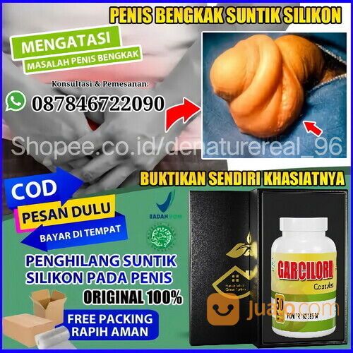 INILAH PAKET EXCLUSIVE GARCILORD MENGHILANGKAN BEKAS SUNTIK SILIKON PADA PENIS TANPA OPERASI MANJUR