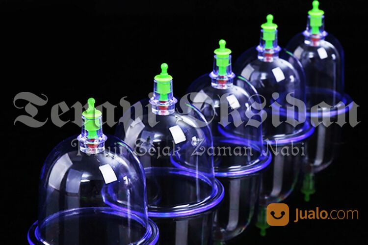 Bekam Batam Ruqyah Batam Bengkel Manusia Indonesia