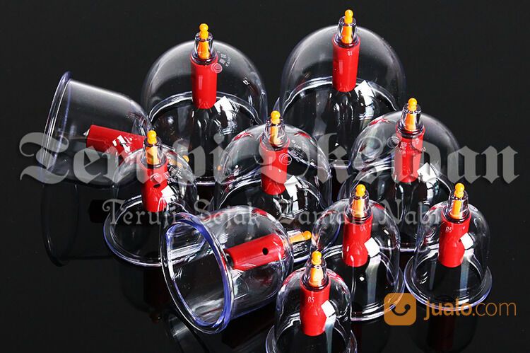 Bekam Batam Ruqyah Batam Bengkel Manusia Indonesia