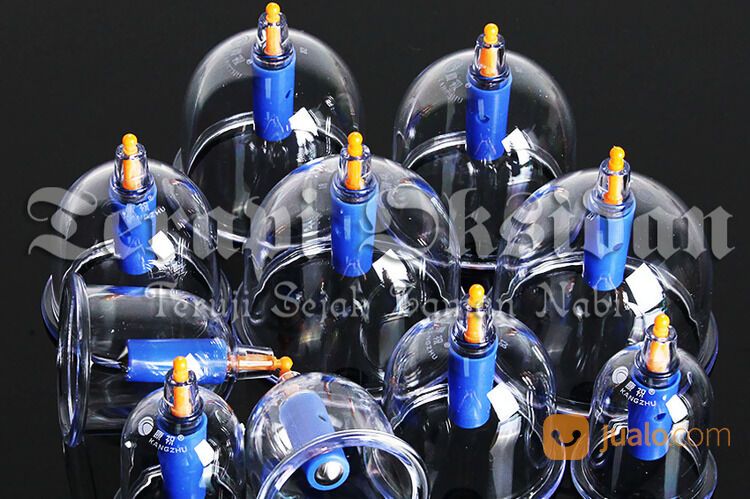 Bekam Batam Ruqyah Batam Bengkel Manusia Indonesia