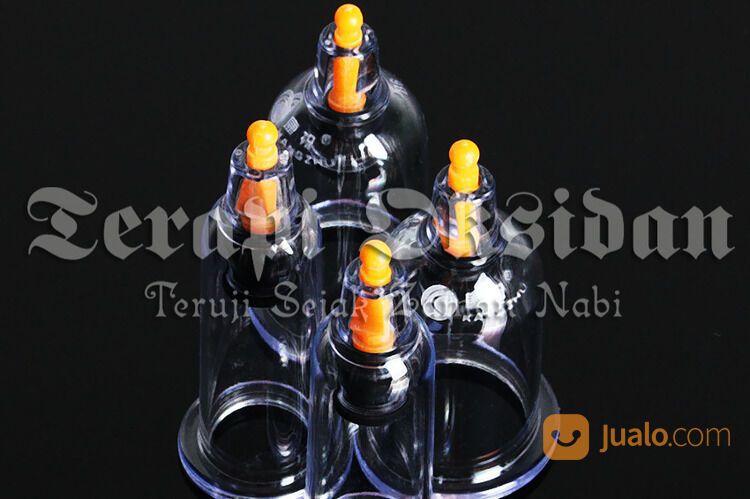 Bekam Batam Ruqyah Batam Bengkel Manusia Indonesia