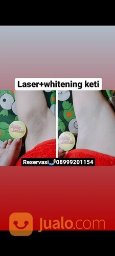 Laser hapus tat / ula / lek wajah terbagus