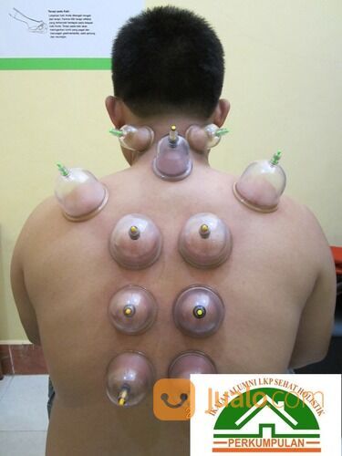 bekam steril surabaya 082223335114