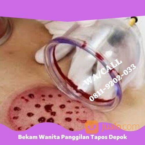 PENGALAMAN, WA 0811-9202-033 Bekam Wanita Panggilan Tapos Depok