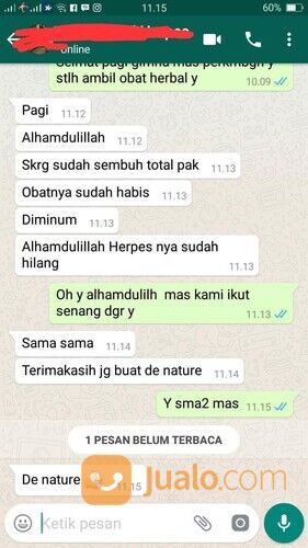 Salep herpes herpes Kulit Herpes genital gatal kulit salep obat penghilang luka bakar kering melepuh