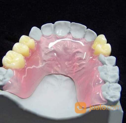 Valplast Gigi Palsu Lentur