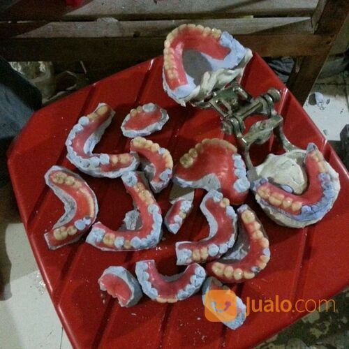 Pasang Gigi Palsu Denpasar