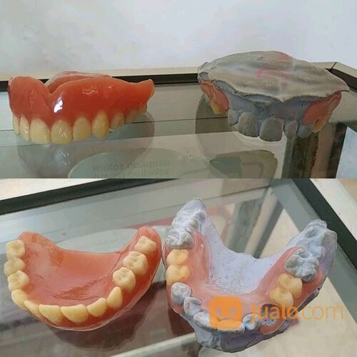 Pasang Gigi Palsu Denpasar