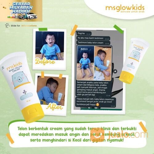Baby Telon Cream/MS Glow Kids
