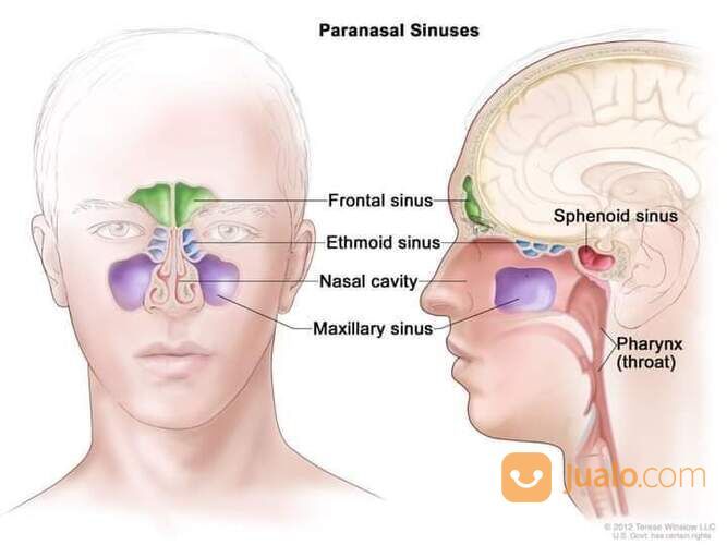 Gurah Hidung (sinusitis)