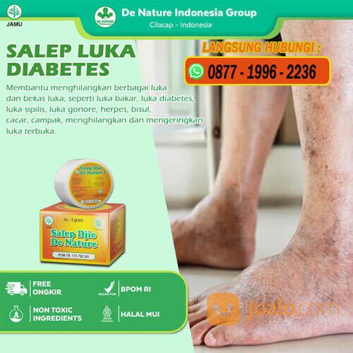 SALEP DJIE 5 GRAM obat luka gongren Diabetes - salep luka bakar - melepuh manjur