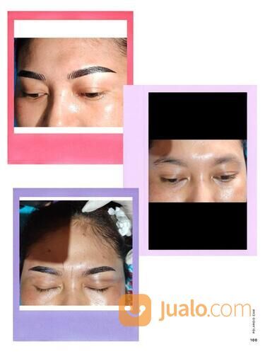 Sualam alis dan infus whaitening