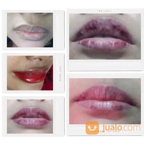 Sualam alis dan infus whaitening