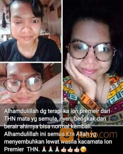 WA : 0895-0766-4080, Kacamata Anti Radiasi Anak Optik Melawai ,Blitar Griya Jelita Kirani
