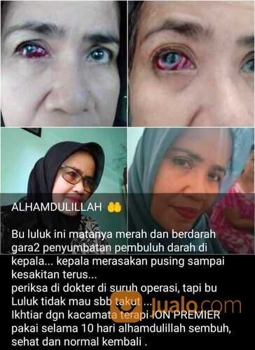 WA : 0895-0766-4080, Kacamata Anti Radiasi Kotak ,Blitar Griya Jelita Kirani