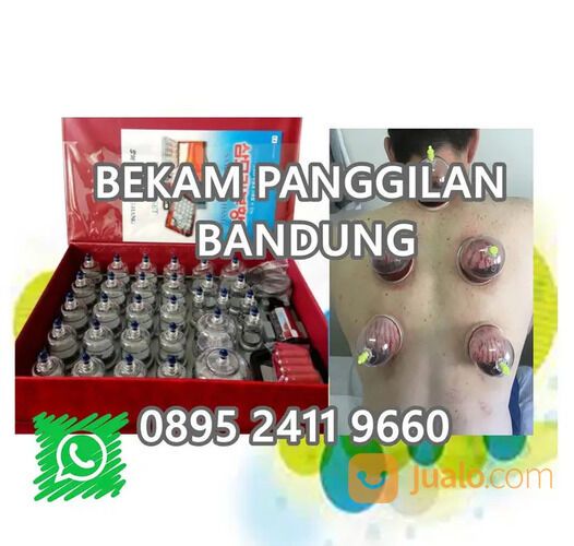 Bekam pijat panggilan bandung Ciparay