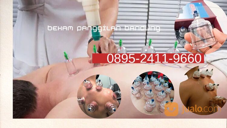 Bekam bandung pria wanita