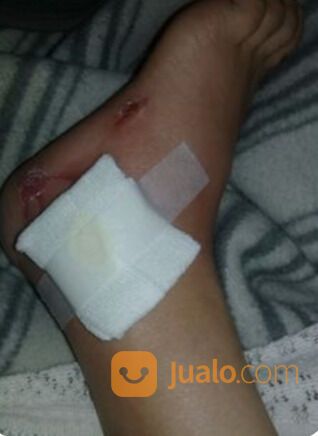 Perawat homecare di jakarta Barat