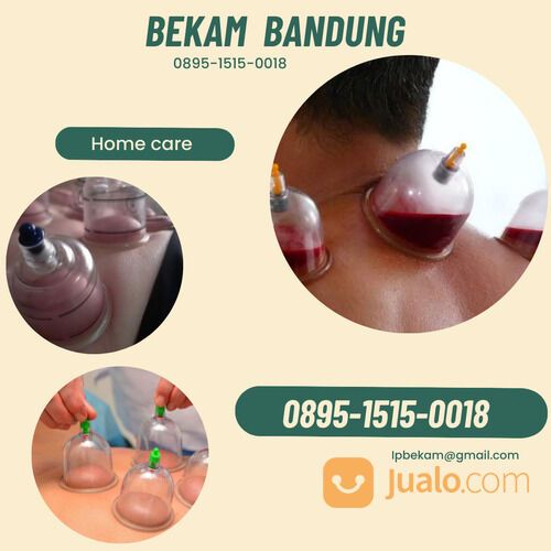 Bekam bandung panggilan pria wanita terpis berpengalaman