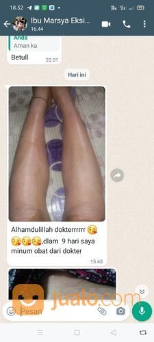 Salep Exclear Obat Eksim Bernanah, Eksim Basah Dan Kering Terbaik Di Apotik