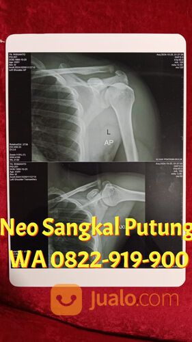 MANJUR!! 0822-919-900, Neo Sangkal Putung Solo,