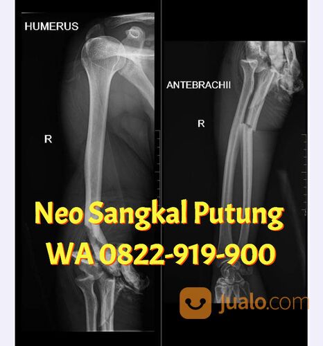 MANJUR!! 0822-919-900, Neo Sangkal Putung Solo,